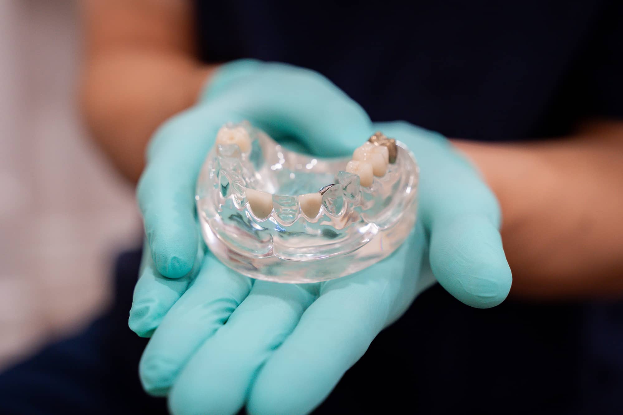 dentist holding mouth model with missing teeth