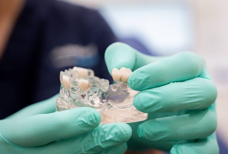 dentist demonstrating how a dental bridge works