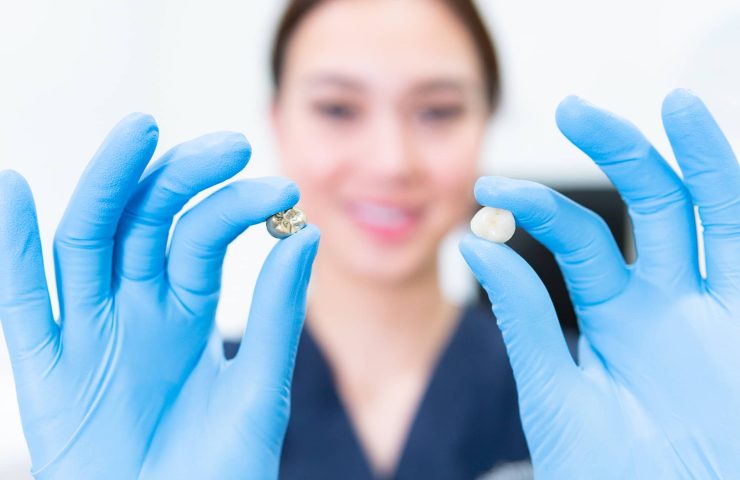 Dentist holding a tooth comparing it to the crown