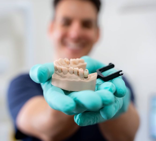 Dentist holding moulded dental implant