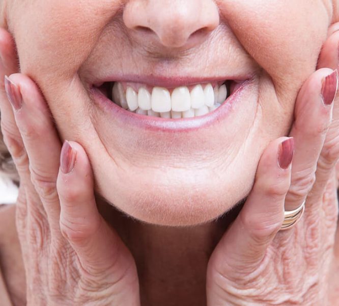lady showing off dentures after dental procedure