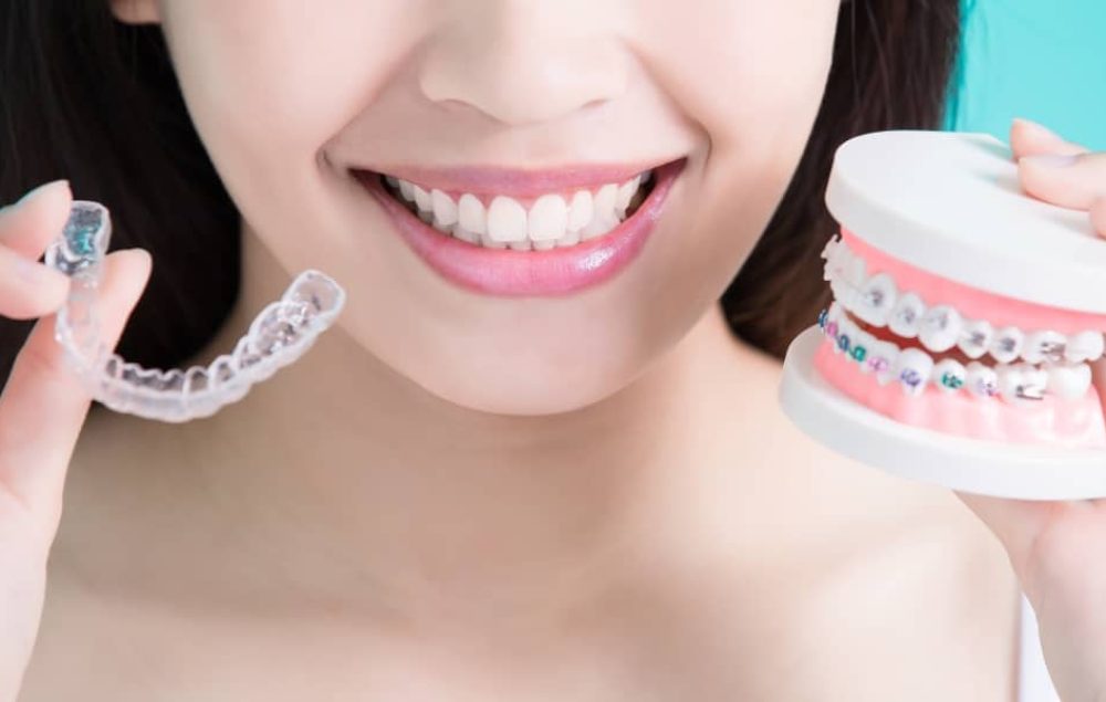 Advancements in orthodontic treatment give you a wider selection of braces.