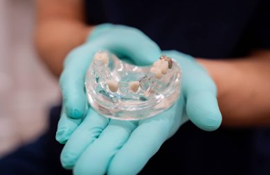 dentist holding mouth model with missing teeth