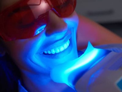 lady using fluoride teeth whitening machine